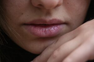 Dark lips- beautyduniya